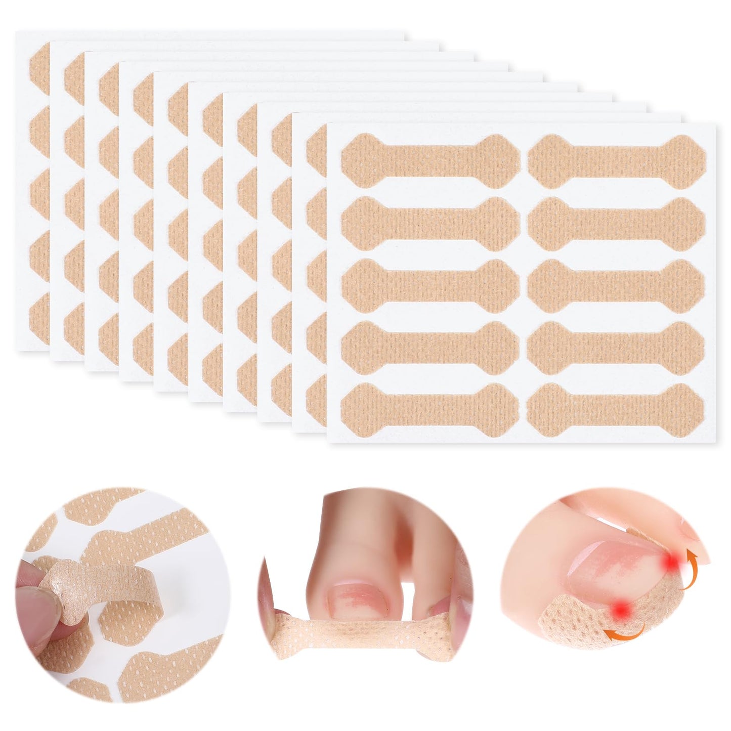 Ingrowing Toenail Kit 100pcs Breathable Ingrown Toenail Non-Woven Fabric Patch Painless Ingrown Toenail Corrector Patches Professional Toenail Corrector Strips for Ingrown Toenail