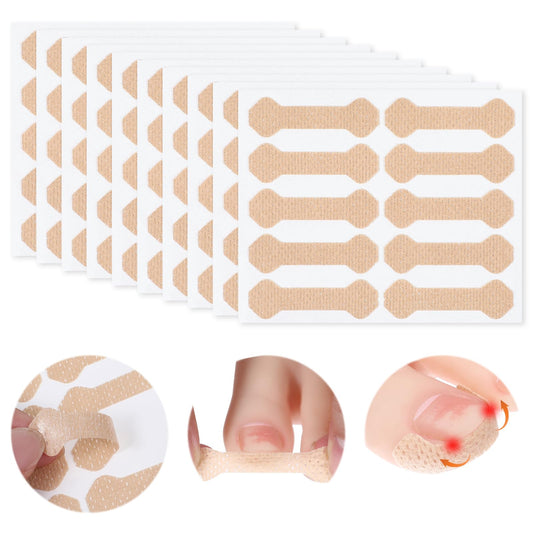 Ingrowing Toenail Kit 100pcs Breathable Ingrown Toenail Non-Woven Fabric Patch Painless Ingrown Toenail Corrector Patches Professional Toenail Corrector Strips for Ingrown Toenail